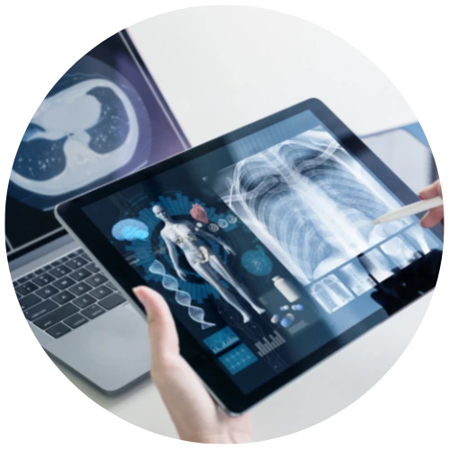 AI-Enabled Medical Imaging: Support in the Radiology Room