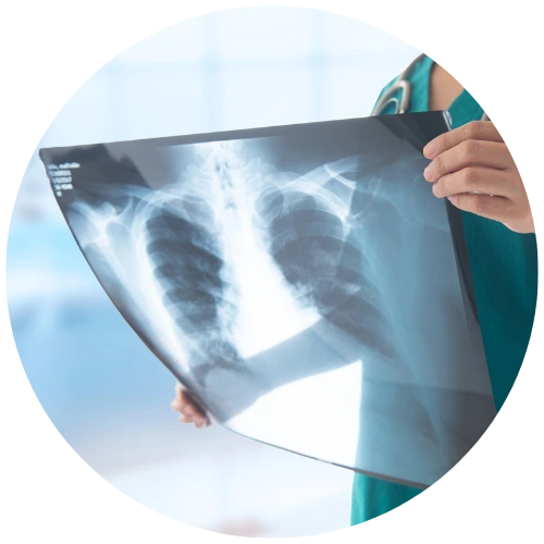 AI-Enabled Medical Imaging: Support in the Radiology Room